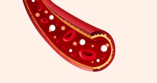 Pengertian, Ciri, Fungsi dan Jenis Pembuluh Nadi (Arteri) Terlengkap