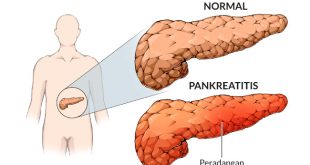 Pengertian, Fungsi, Stuktur, Gambar Anatomi dan Penyakit Pada Pankreas Terlengkap