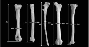 Proses Pembentukan Tulang (Osifikasi) Pada Manusia Secara Lengkap